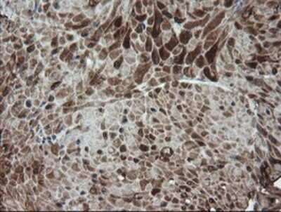 Immunohistochemistry: DEF6 Antibody (OTI3F9) [NBP2-46456]