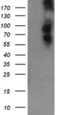 Western Blot: DEF6 Antibody (OTI3F9) [NBP2-46456]