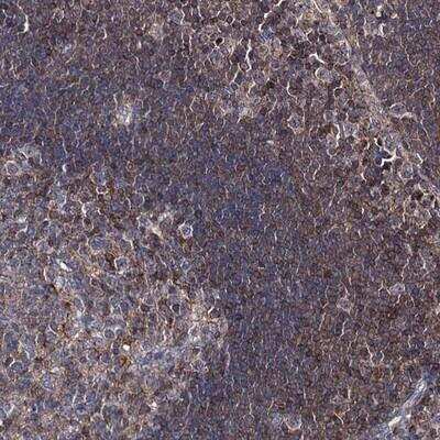 Immunohistochemistry-Paraffin: DEF6 Antibody [NBP1-81617]