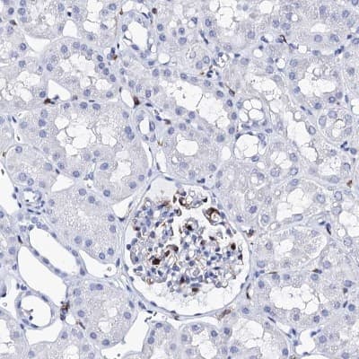 Immunohistochemistry-Paraffin: DEF6 Antibody [NBP1-81618]