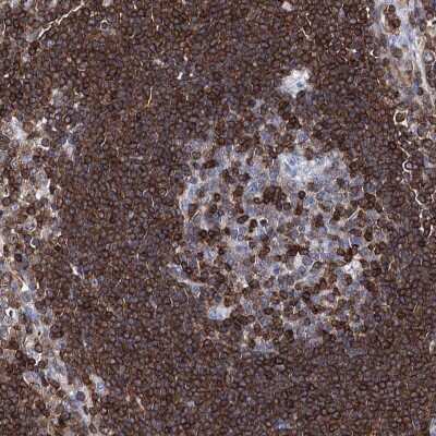 Immunohistochemistry-Paraffin: DEF6 Antibody [NBP1-81618]