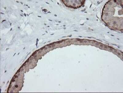 Immunohistochemistry: DEF6 Antibody (OTI3F9) - Azide and BSA Free [NBP2-71868]