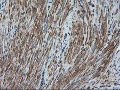 Immunohistochemistry: DEF6 Antibody (OTI3F9) - Azide and BSA Free [NBP2-71868]