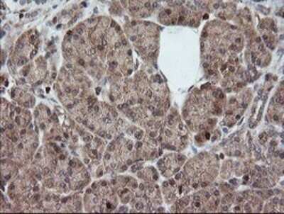 Immunohistochemistry: DEF6 Antibody (OTI3F9) - Azide and BSA Free [NBP2-71868]