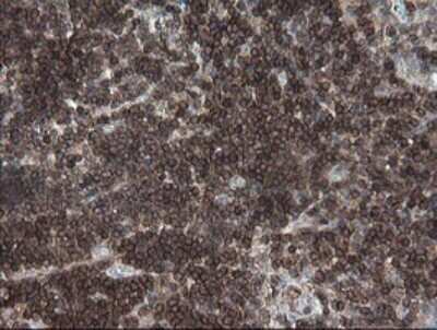 Immunohistochemistry: DEF6 Antibody (OTI3F9) - Azide and BSA Free [NBP2-71868]