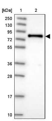 Western Blot: DEF6 Antibody [NBP1-81618]
