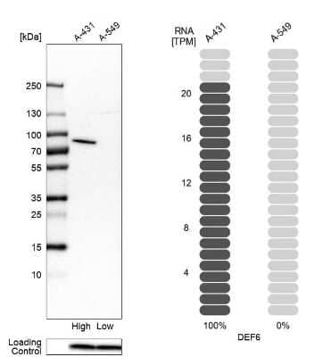 Western Blot: DEF6 Antibody [NBP1-81618]