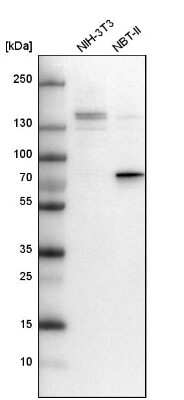 Western Blot: DEF6 Antibody [NBP1-81618]