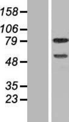 Western Blot: DEF6 Overexpression Lysate [NBP2-06481]