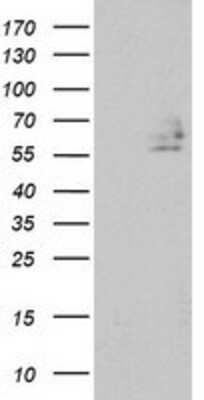 Western Blot: DEF8 Antibody (OTI4B6) [NBP2-00574]