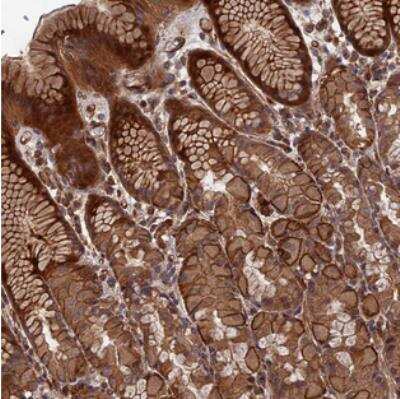 Immunohistochemistry: DEF8 Antibody [NBP2-30679]