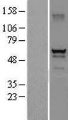 Western Blot: DEF8 Overexpression Lysate [NBL1-09817]