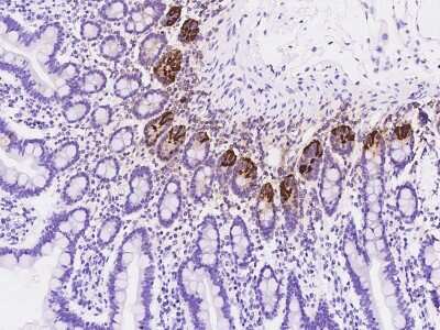 Immunohistochemistry-Paraffin: DEFA6 Antibody [NBP2-97543]