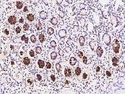 Immunohistochemistry-Paraffin: DEFA6 Antibody [NBP2-97543]