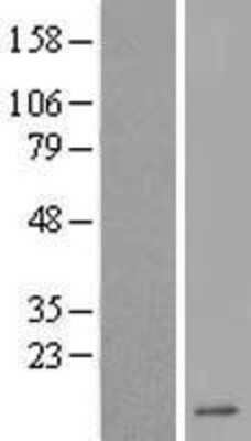 Western Blot: DEFA6 Overexpression Lysate [NBL1-09821]