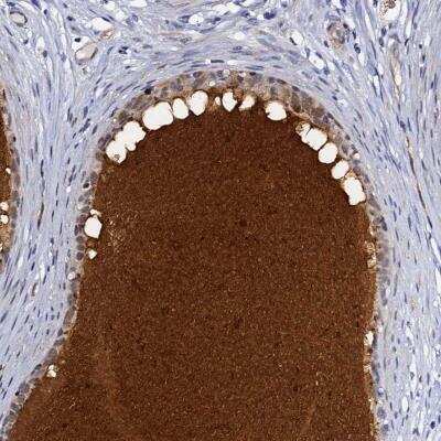 Immunohistochemistry: DEFB104A Antibody [NBP2-59792]