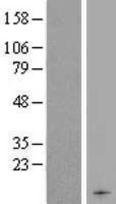 Western Blot: DEFB104A Overexpression Lysate [NBP2-05785]