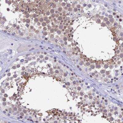 Immunohistochemistry: DEFB107A Antibody [NBP2-59793]