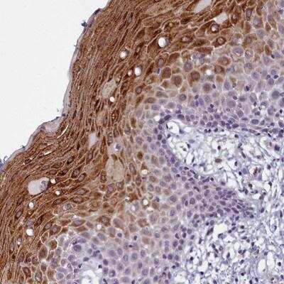 Immunohistochemistry: DEFB108B Antibody [NBP1-94153]