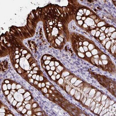 Immunohistochemistry-Paraffin: DEFB115 Antibody [NBP2-14778]