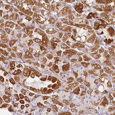 Immunohistochemistry-Paraffin: DEFB116 Antibody [NBP1-94089]