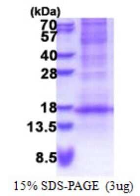 SDS-PAGE: Recombinant Human DEFB116 His Protein [NBP2-22992]