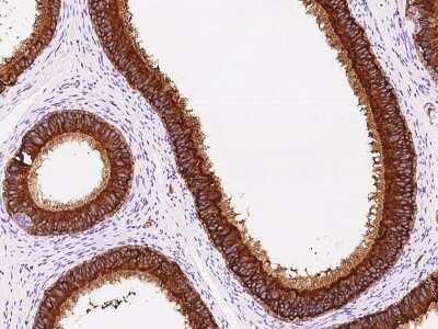 Immunohistochemistry: DEFB118 Antibody [NBP2-97548]