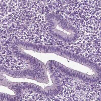 Immunohistochemistry-Paraffin: DEFB118 Antibody [NBP1-90695]