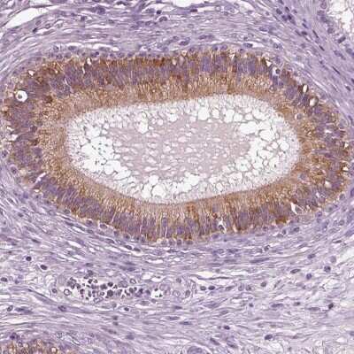 Immunohistochemistry-Paraffin: DEFB118 Antibody [NBP1-90695]