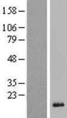 Western Blot: DEFB118 Overexpression Lysate [NBP2-05810]