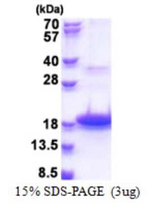 SDS-PAGE: Recombinant Human DEFB118 His Protein [NBP2-22993]