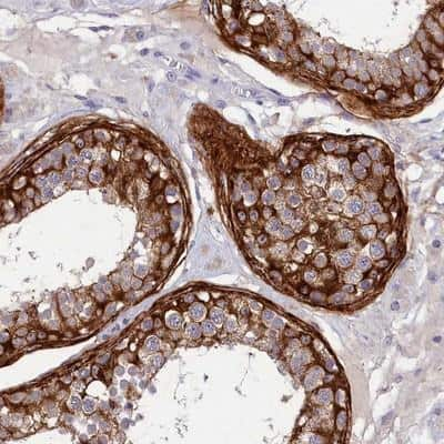 Immunohistochemistry-Paraffin: DEFB119 Antibody [NBP1-84280]