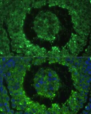 Immunocytochemistry/ Immunofluorescence: DEFB121 Antibody - BSA Free [NBP3-04788]