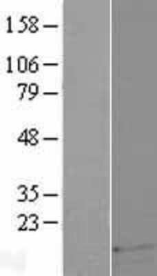 Western Blot: DEFB121 Overexpression Lysate [NBP2-08788]