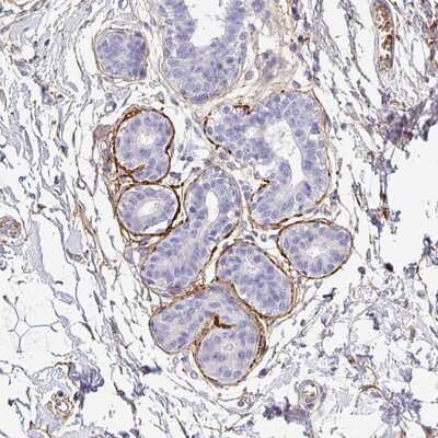 Immunohistochemistry-Paraffin: DEFB124 Antibody [NBP2-14718]