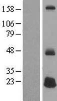 Western Blot: DEFB125 Overexpression Lysate [NBP2-05252]