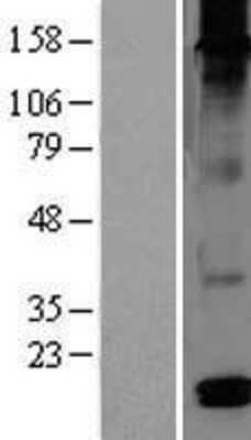 Western Blot: DEFB126 Overexpression Lysate [NBL1-09824]