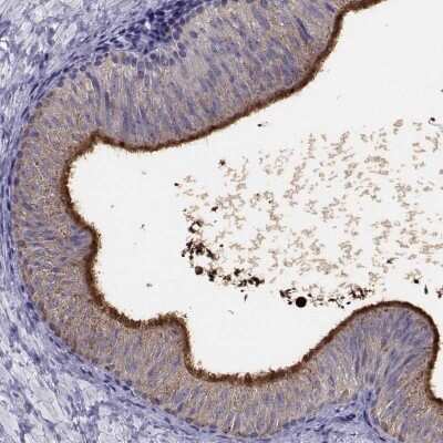 Immunohistochemistry: DEFB129 Antibody [NBP2-68588]