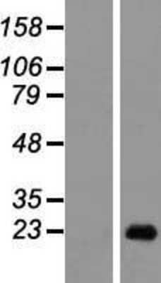 Western Blot: DEFB129 Overexpression Lysate [NBL1-09825]