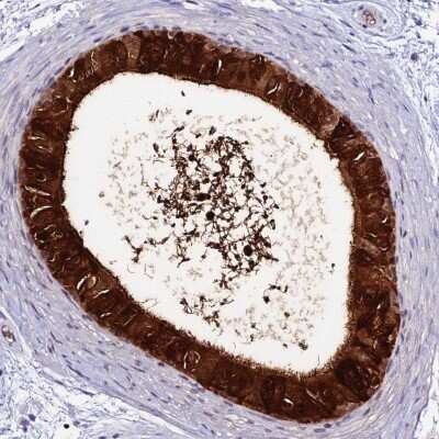 Immunohistochemistry-Paraffin: DEFB132 Antibody [NBP1-94087]