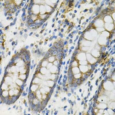 Immunohistochemistry-Paraffin: DEFB132 Antibody - BSA Free [NBP3-04817]
