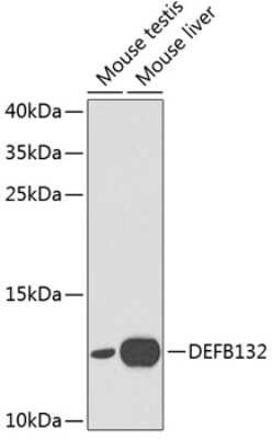 Western Blot: DEFB132 AntibodyBSA Free [NBP2-92037]