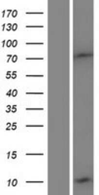 Western Blot: DEFB132 Overexpression Lysate [NBP2-04504]