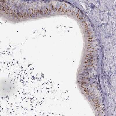 Immunohistochemistry: DEFB136 Antibody [NBP2-68867]