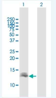 Western Blot: DEFB136 Antibody [H00613210-B01P-50ug]