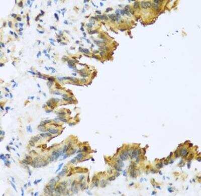 Immunohistochemistry-Paraffin: DEFB4B Antibody - BSA Free [NBP3-05559]