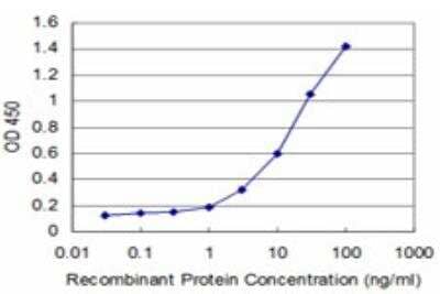 ELISA: DEGS1 Antibody (2E9) [H00008560-M04]