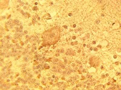 Immunohistochemistry: DEGS1 Antibody [NBP3-11921]