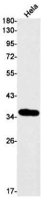 Western Blot: DEGS1 Antibody (S03-5D2) [NBP3-19964]