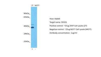 Western Blot: DEGS1 Antibody [NBP1-59941]